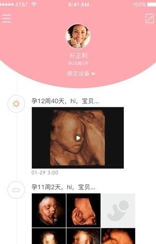 胎儿相机  v1.5.3图5